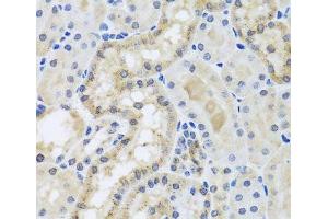 Immunohistochemistry (Paraffin-embedded Sections) (IHC (p)) image for anti-Centrin, EF-Hand Protein, 3 (CETN3) antibody (ABIN7264157)
