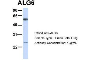 Host:  Rabbit  Target Name:  ALG6  Sample Type:  Human Fetal Lung  Antibody Dilution:  1. (ALG6 抗体  (N-Term))