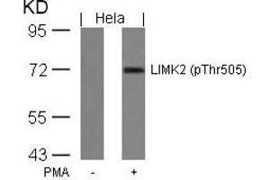 Western blot analysis of extracts from Hela cells untreated or treated with PMA using LIMK2(Phospho-Thr505) Antibody. (LIMK2 抗体  (pThr505))