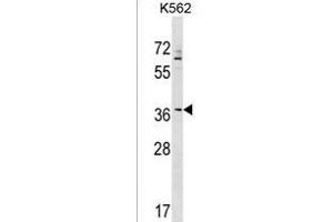 ZNF385A Antibody (N-term) (ABIN1539472 and ABIN2849352) western blot analysis in K562 cell line lysates (35 μg/lane). (ZNF385A 抗体  (N-Term))