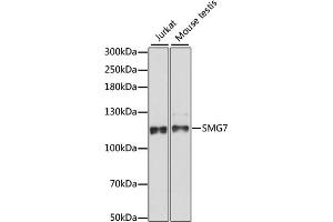 Western blot analysis of extracts of various cell lines, using SMG7 antibody (ABIN7270376) at 1:1000 dilution. (SMG7 抗体  (AA 1-300))