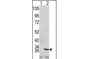 Western blot analysis of GRB2 (arrow) using GRB2 Antibody (Center) (ABIN390238 and ABIN2840708). (GRB2 抗体  (AA 89-118))