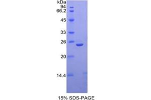 SDS-PAGE of Protein Standard from the Kit (Highly purified E. (Thrombospondin 1 CLIA Kit)