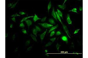 Immunofluorescence of monoclonal antibody to RAB3B on HeLa cell. (RAB3B 抗体  (AA 120-219))