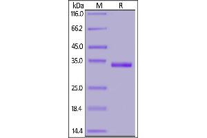 SARS-CoV-2 S protein RBD (W436R), His Tag on SDS-PAGE under reducing (R) condition. (SARS-CoV-2 Spike S1 Protein (RBD, W436R) (His tag))