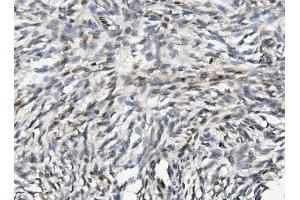 IHC analysis of NHEJ1 using anti-NHEJ1 antibody (ABIN7599198).