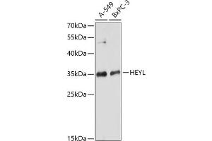 Western blot analysis of extracts of various cell lines, using HEYL antibody (ABIN7267563) at 1:1000 dilution. (HEYL 抗体  (AA 129-328))