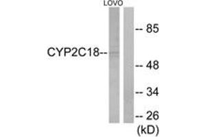 Western blot analysis of extracts from LOVO cells, using Cytochrome P450 2C8/9/18/19 Antibody. (Cytochrome P450 2C8/9/18/19 (AA 111-160) 抗体)