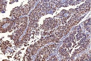 IHC analysis of FEN1 using anti-FEN1 antibody (ABIN7601618).