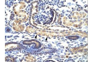 SNAI1 antibody was used for immunohistochemistry at a concentration of 4-8 ug/ml.