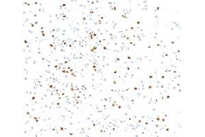 Immunocytochemistry (ICC) image for anti-Forkhead Box M1 (FOXM1) (AA 650-700) antibody (ABIN7795806) (Recombinant FOXM1 抗体  (AA 650-700))