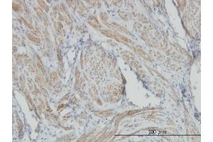 Immunoperoxidase of monoclonal antibody to ACTB on formalin-fixed paraffin-embedded human smooth muscle. (beta Actin 抗体  (AA 1-375))