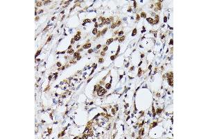Immunohistochemistry (IHC) image for anti-Heterogeneous Nuclear Ribonucleoprotein M (HNRNPM) (AA 491-730) antibody (ABIN6141919)