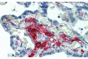 Detection of FE in Human Placenta Tissue using Polyclonal Antibody to Ferritin (FE) (Ferritin 抗体)