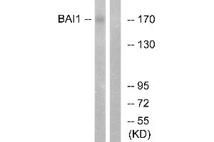 Immunohistochemistry analysis of paraffin-embedded human brain tissue using BAI1 antibody. (BAI1 抗体  (Internal Region))
