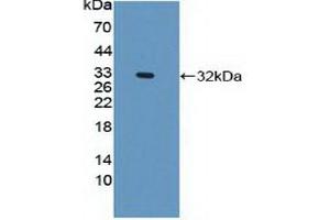 Detection of Recombinant PLEC, Human using Polyclonal Antibody to Plectin (PLEC) (PLEC 抗体  (AA 175-400))