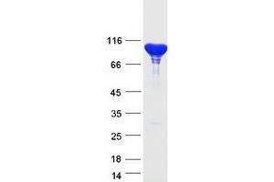 Validation with Western Blot