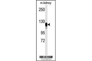 Western blot analysis of anti-EGFR Antibody (S1070) in kidney heart tissue lysates (35ug/lane) (EGF 抗体  (AA 1048-1077))