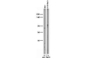 Adult rat brain membrane (RBM) and transfected cell immunoblot: extracts of RBM and COS cells transiently transfected with TrpC4 and probed with N77/15 TC supe.