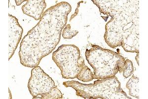 Immunohistochemical analysis of paraffin-embedded Human placenta section using Pink1 . (CD59 抗体  (AA 74-110))