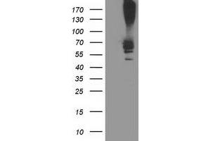 Western Blotting (WB) image for anti-Ribophorin 1 (RPN1) antibody (ABIN1500754) (RPN1 抗体)