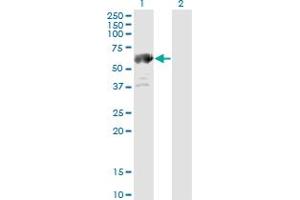 Western Blotting (WB) image for anti-Aldehyde Dehydrogenase 4 Family, Member A1 (ALDH4A1) (AA 1-564) antibody (ABIN599053) (ALDH4A1 抗体  (AA 1-564))