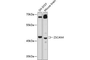 Western blot analysis of extracts of various cell lines, using ZSC antibody (ABIN6133026, ABIN6150544, ABIN6150546 and ABIN6215572) at 1:3000 dilution. (ZSCAN4 抗体  (AA 1-310))