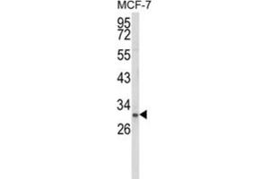Western Blotting (WB) image for anti-NK3 Homeobox 1 (NKX3-1) antibody (ABIN3003998) (NKX3-1 抗体)