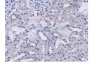 Detection of AGXT2 in Rat Kidney Tissue using Polyclonal Antibody to Alanine Glyoxylate Aminotransferase 2 (AGXT2) (AGXT2 抗体  (AA 225-512))
