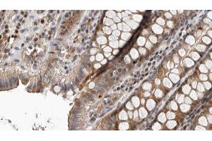 ABIN6276765 at 1/100 staining Rat colon tissue by IHC-P. (IDO1 抗体  (Internal Region))