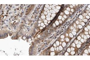 ABIN6276765 at 1/100 staining Rat colon tissue by IHC-P.