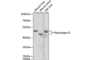 Western blot analysis of extracts of various cell lines using Pepsinogen II Polyclonal Antibody at dilution of 1:1000. (PGC 抗体)
