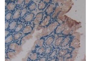 Detection of CXCL16 in Mouse Intestine Tissue using Polyclonal Antibody to Chemokine C-X-C-Motif Ligand 16 (CXCL16) (CXCL16 抗体  (AA 31-241))