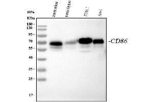 Western blot analysis of CD86 using anti-CD86 antibody (ABIN3042788).