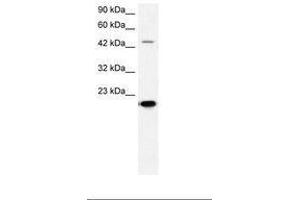 Image no. 2 for anti-Matrix Metallopeptidase 19 (MMP19) (AA 349-398) antibody (ABIN202685) (MMP19 抗体  (AA 349-398))