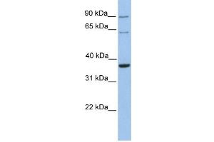 TMEM123 antibody used at 1 ug/ml to detect target protein.