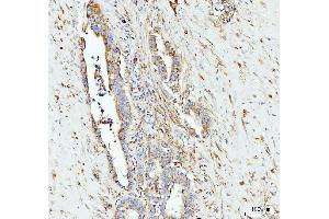 IHC analysis of Grp75 using anti-Grp75 antibody (ABIN7602782). (HSPA9 抗体  (C-Term))