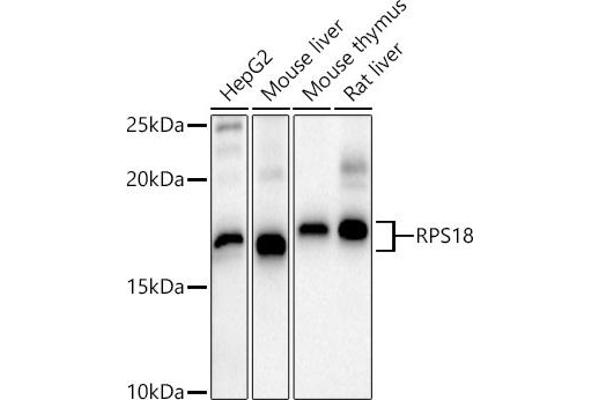 RPS18 抗体  (AA 1-152)