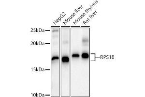 Western blot analysis of extracts of various cell lines, using RPS18 antibody (ABIN6128660, ABIN6147205, ABIN6147206 and ABIN6215379) at 1:1000 dilution. (RPS18 抗体  (AA 1-152))