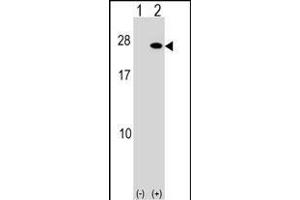 Western blot analysis of FGF19 (arrow) using rabbit polyclonal FGF19 Antibody (C-term) (ABIN1536785 and ABIN2849728). (FGF19 抗体  (C-Term))