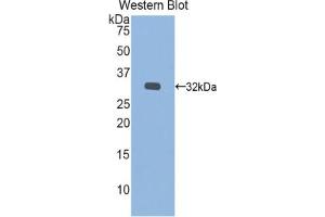Western blot analysis of the recombinant protein. (IDS 抗体  (AA 180-448))