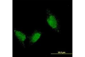 Image no. 1 for anti-Titin (TTN) (AA 1-111) antibody (ABIN598990) (Titin 抗体  (AA 1-111))