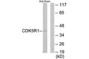 Western Blotting (WB) image for anti-Cyclin-Dependent Kinase 5, Regulatory Subunit 1 (p35) (CDK5R1) (AA 11-60) antibody (ABIN2889601) (CDK5R1 抗体  (AA 11-60))
