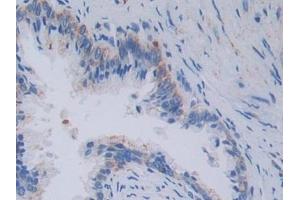 Detection of TOP3 in Human Prostate Tissue using Polyclonal Antibody to Topoisomerase III (TOP3) (TOP3 抗体  (AA 35-179))