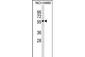 ZN Antibody (N-term) (ABIN1539437 and ABIN2849988) western blot analysis in NCI- cell line lysates (35 μg/lane). (ZNF302 抗体  (N-Term))