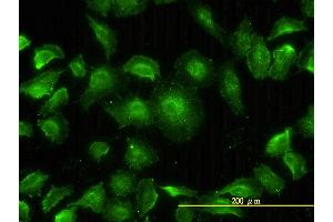 Immunofluorescence of monoclonal antibody to MAPK13 on HeLa cell. (MAPK13 抗体  (AA 1-365))