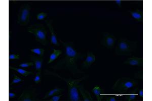 Immunofluorescence of monoclonal antibody to LCAT on HeLa cell. (LCAT 抗体  (AA 98-197))