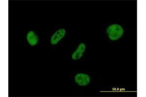 Immunofluorescence of purified MaxPab antibody to BAP1 on HeLa cell. (BAP1 抗体  (AA 1-729))