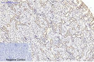 Immunohistochemical analysis of paraffin-embedded rat kidney tissue. (TUBB2A 抗体)