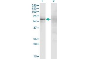 Western Blot analysis of ZNF180 expression in transfected 293T cell line by ZNF180 monoclonal antibody (M01), clone 4F3. (ZNF180 抗体  (AA 176-285))